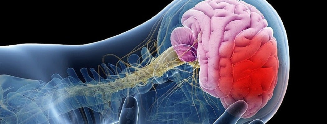 A man sitting at a desk holding his temples in distress, illustrating the neurological symptoms like headaches and dizziness associated with Microwave Syndrome and EMF sensitivity.