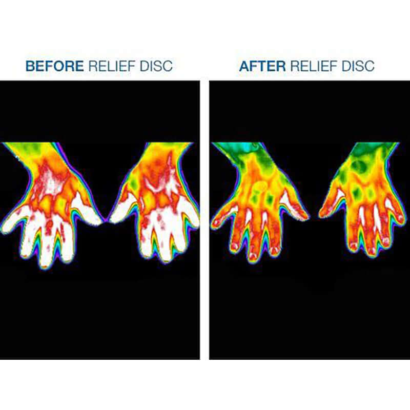 Before and after comparison of hands treated with Body Relief - Pain Patches, showcasing improved comfort and movement.