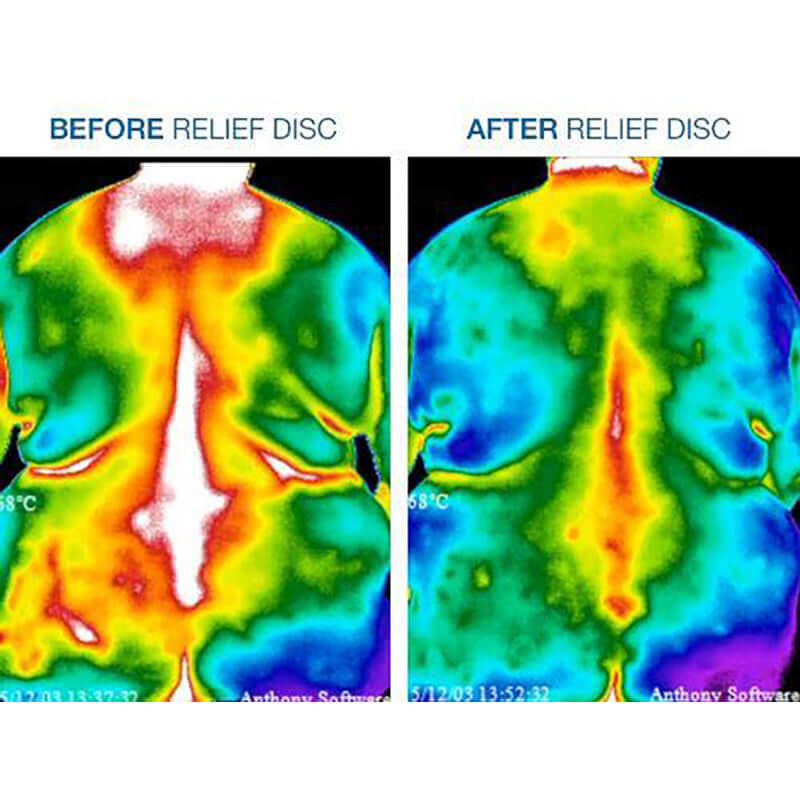 Body Relief - Pain Patches thermal imaging before and after using relief discs for pain management.