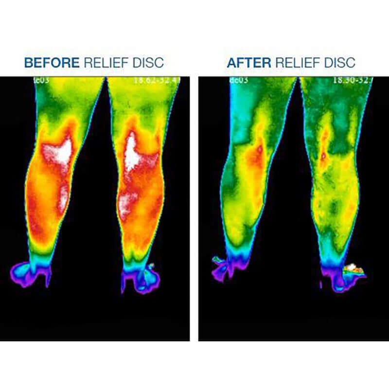 Before and after images showing leg pain relief with Body Relief - Pain Patches using bio-frequency resonance signals.